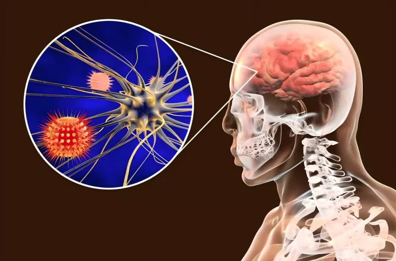 Meningococcal Vaccine Guide Meningococcal Vaccine Guide